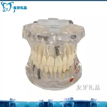 Модель зубов для взрослых, прозрачная патологическая посадочная модель, бесплатная доставка